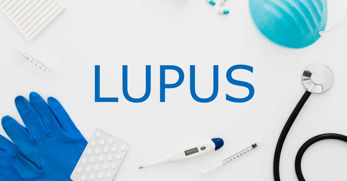 CBD y Lupus